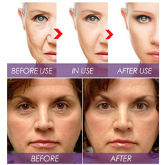 Venature conceptual before and after illustration showing improved texture