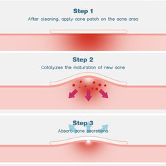 Venrock active ingredients graphic highlighting salicylic acid and botanical calming benefit