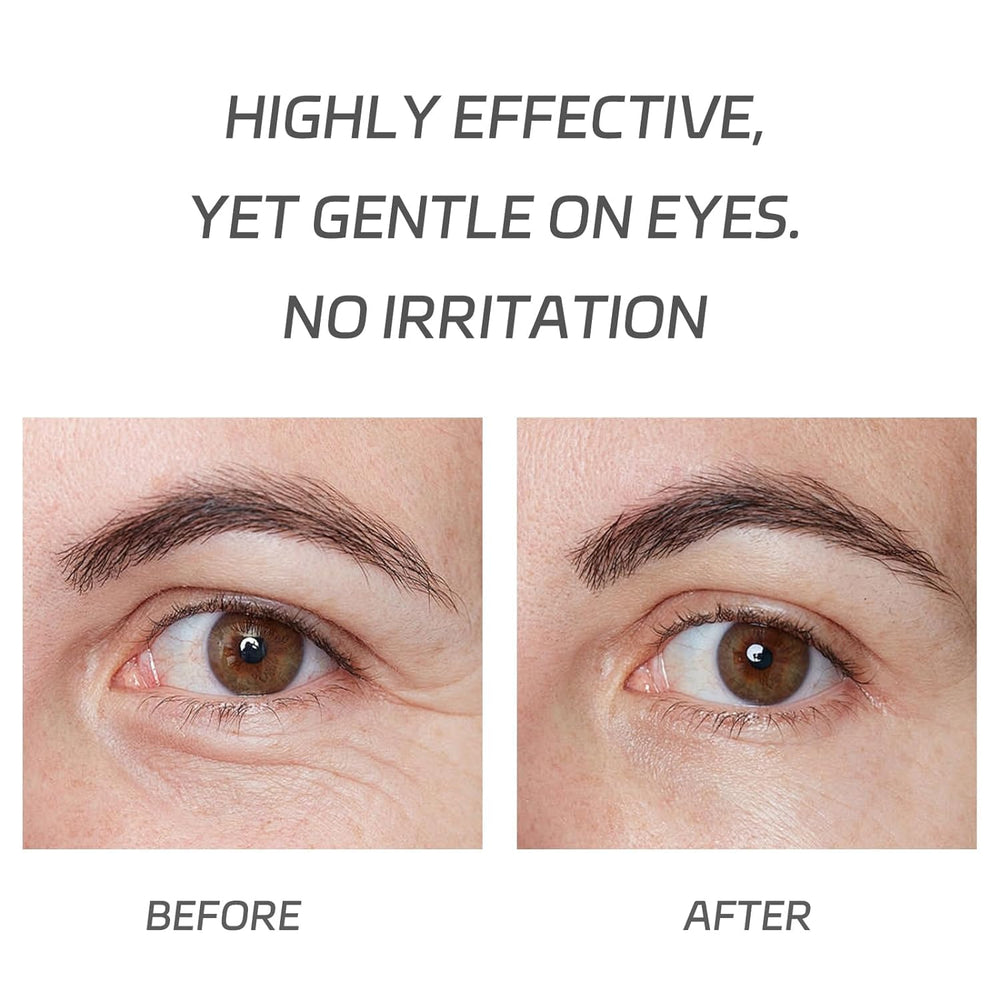 VGO simulated before and after under-eye view showing reduced puffiness look