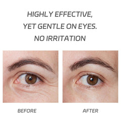 VGO simulated before and after under-eye view showing reduced puffiness look