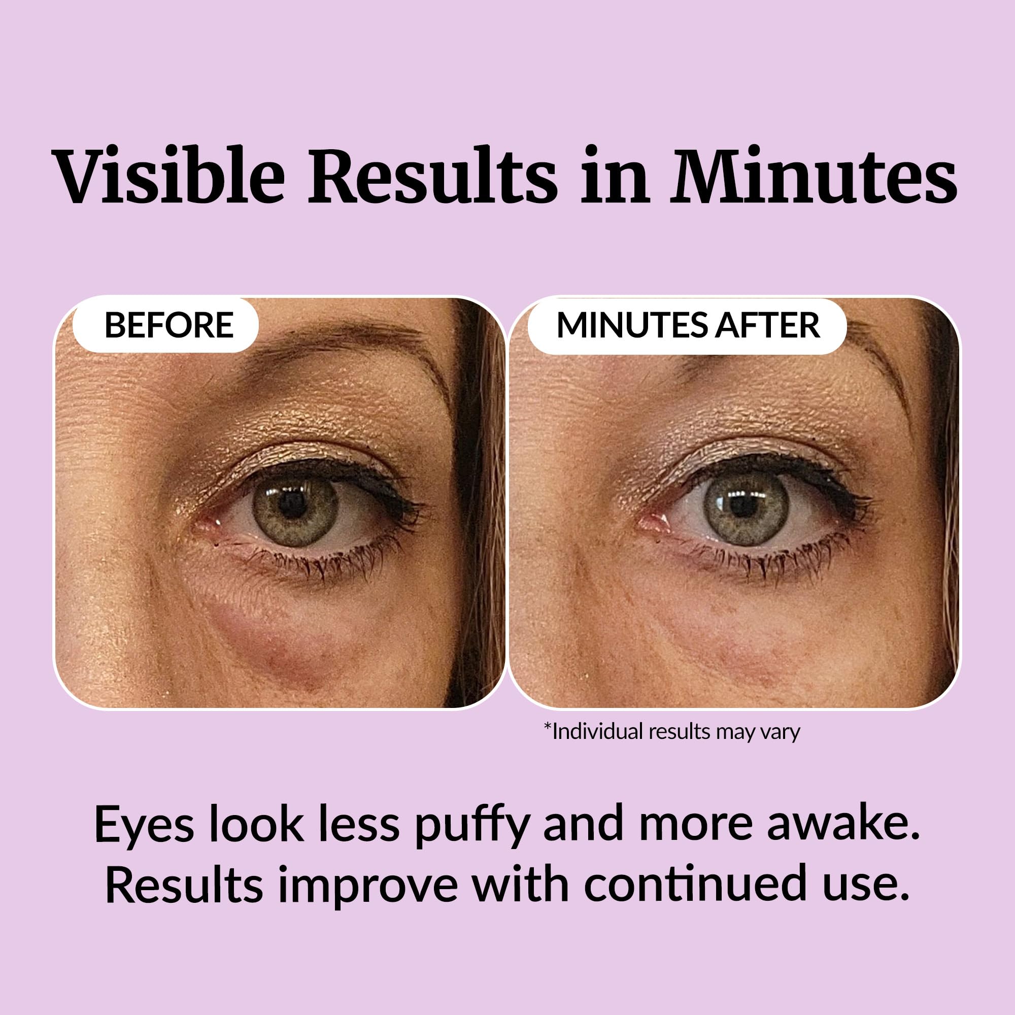 Vibriance applying serum under eye demonstrating de-puffing effect