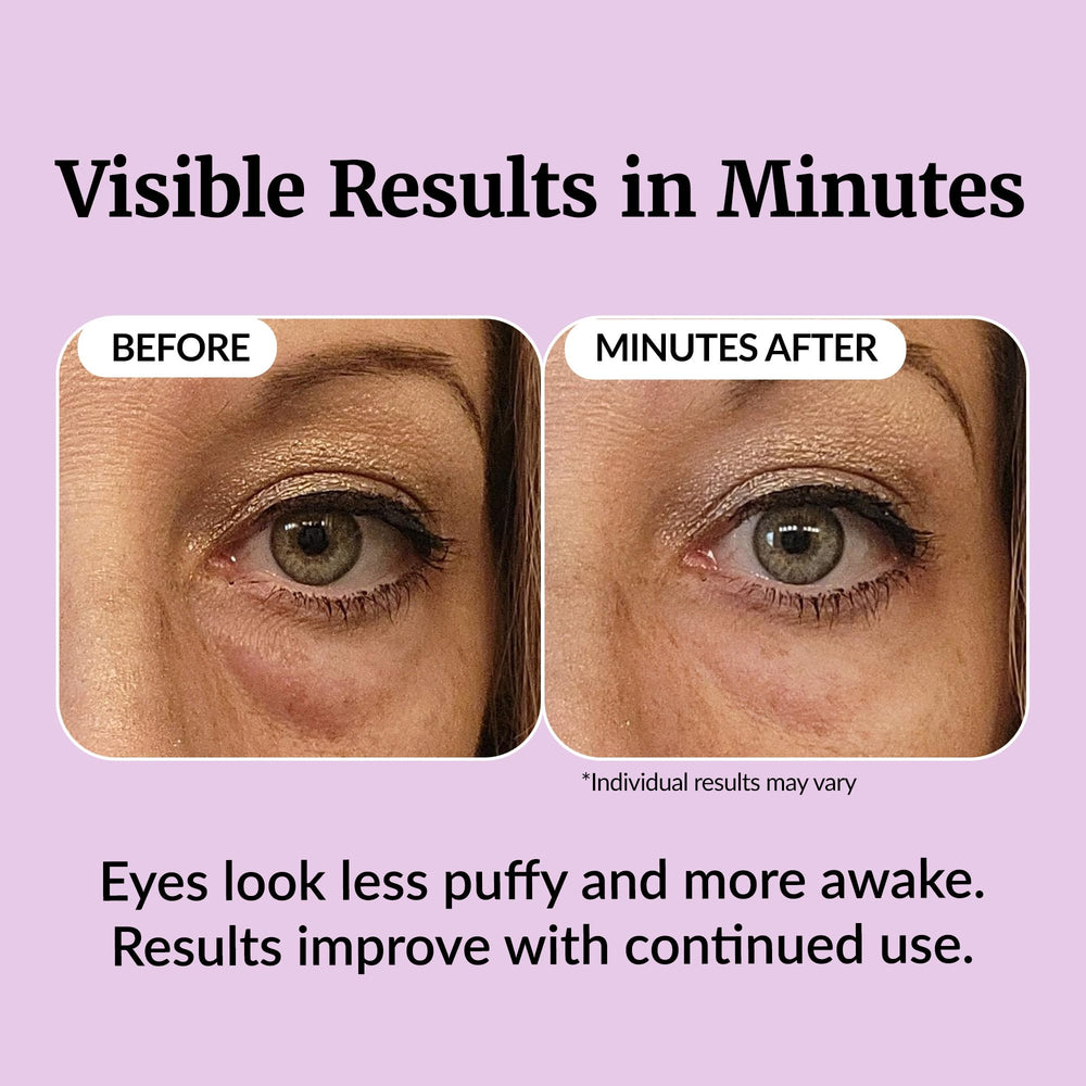 Vibriance applying serum under eye demonstrating de-puffing effect