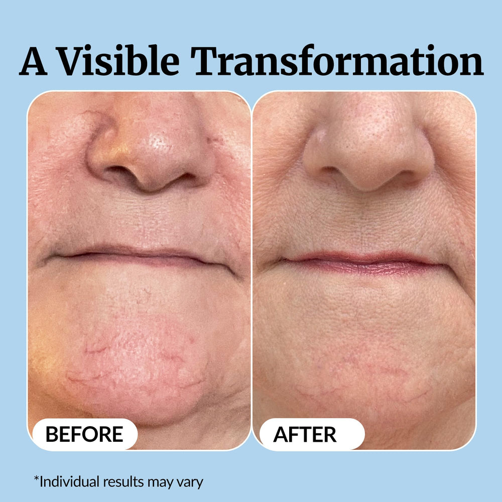 Vibriance application under-eye demonstration for gentle targeted use