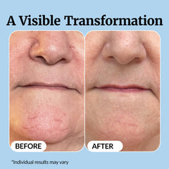 Vibriance applied near eye area to show gentle formula suitable for delicate skin