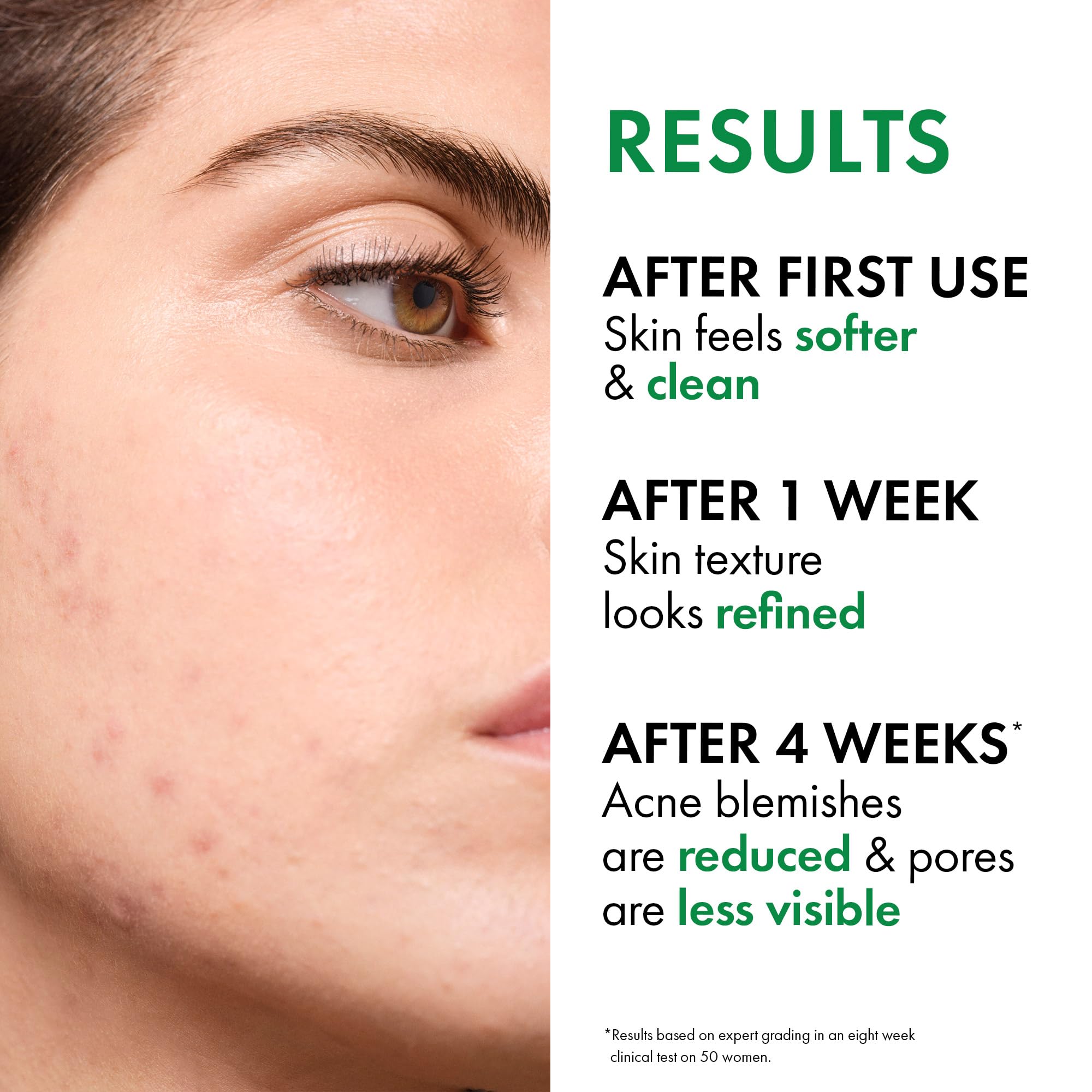 VICHY salicylic acid ingredient visual emphasizing pore-exfoliating benefit