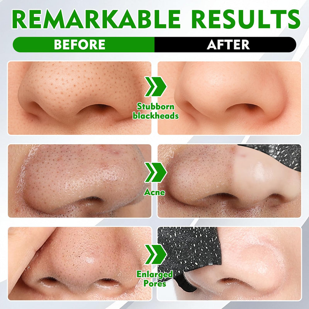 Vigorder nose strip applied showing secure adhesion and ease