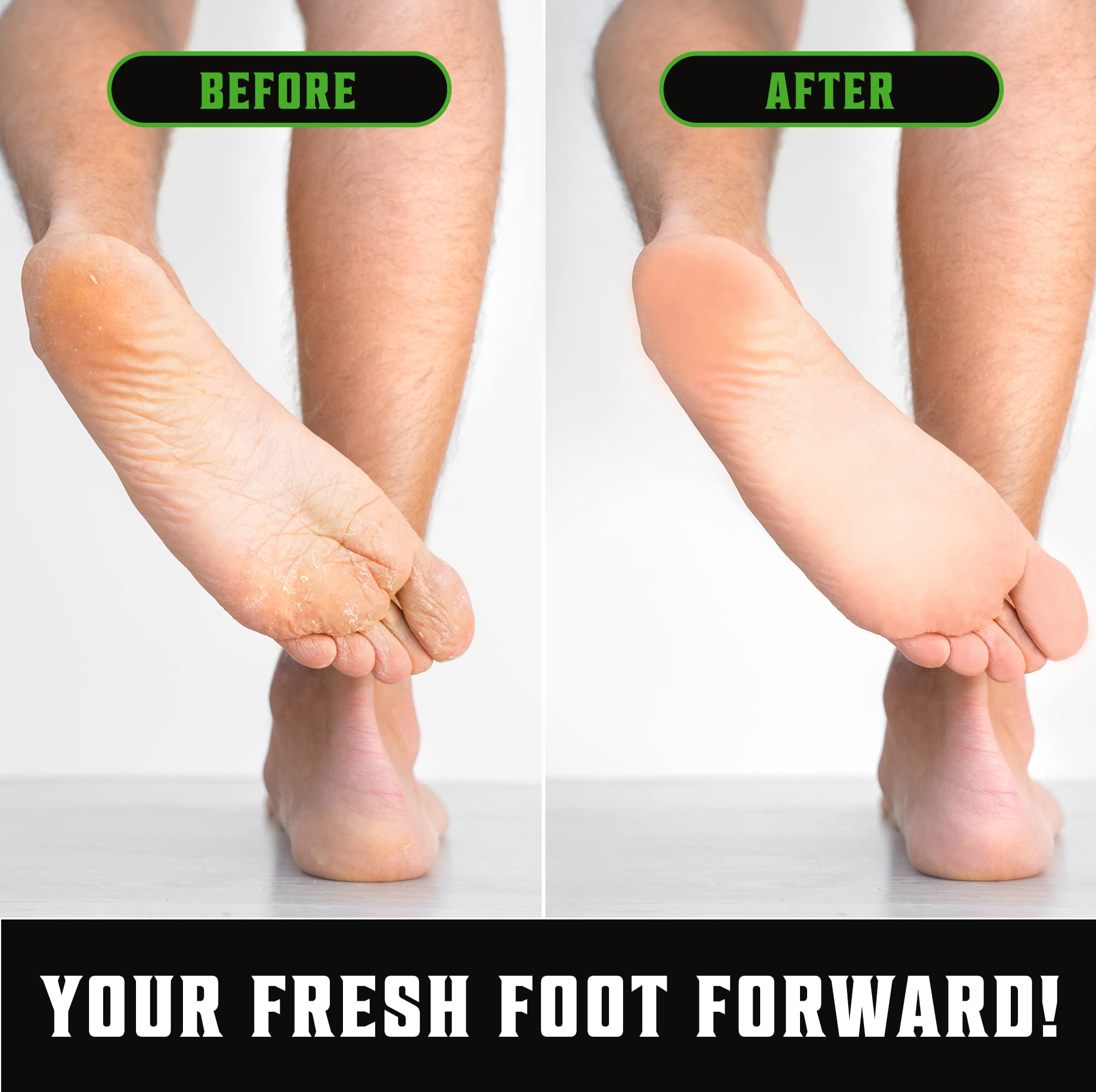Viking Revolution foot soak setup illustrating targeted foot care