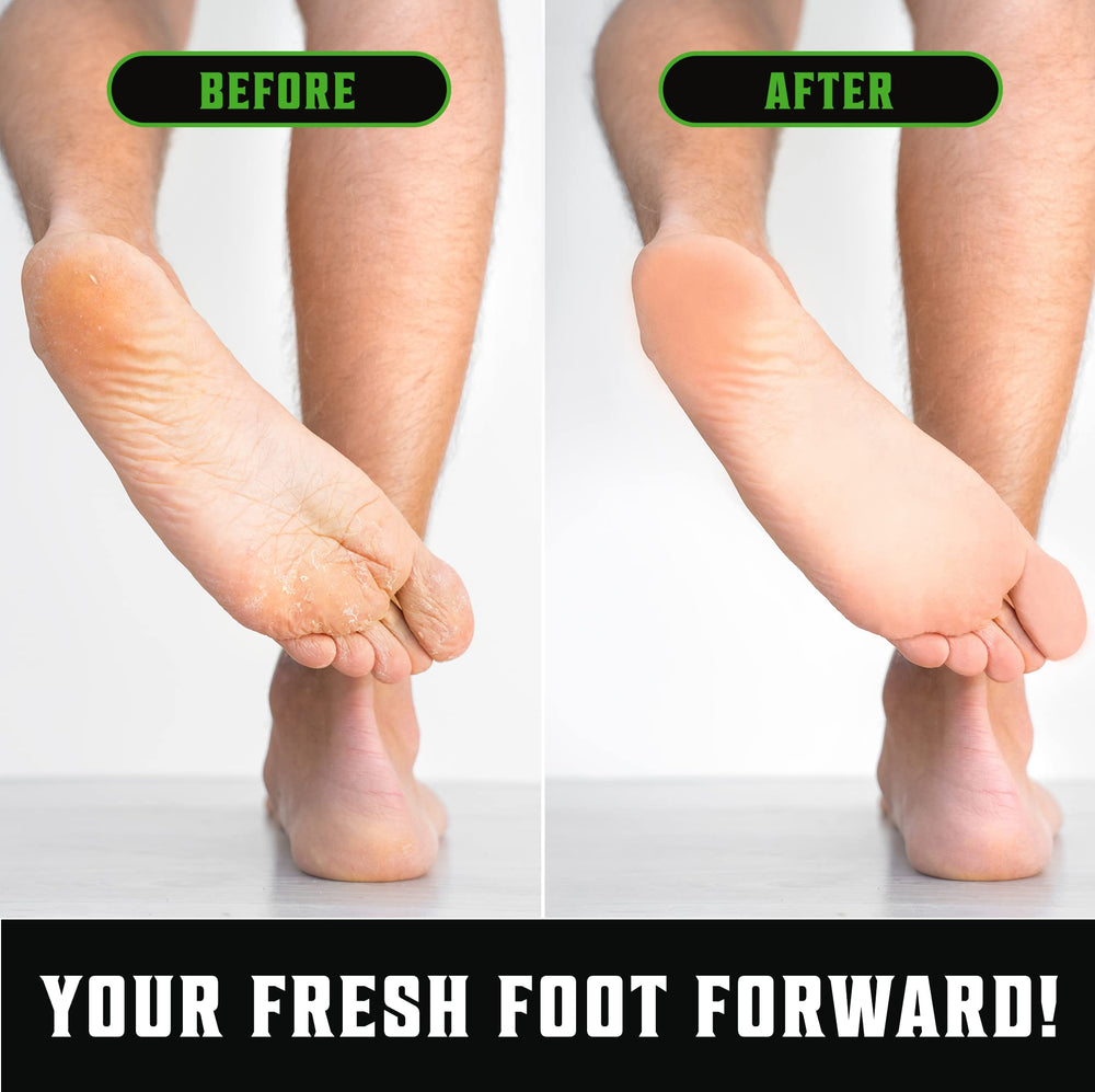 Viking Revolution foot soak setup illustrating targeted foot care
