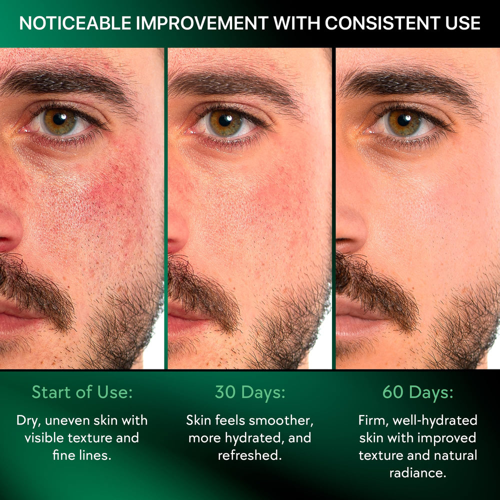 Viva Lab applied after shaving to cheek area demonstrating soothing, calming benefit
