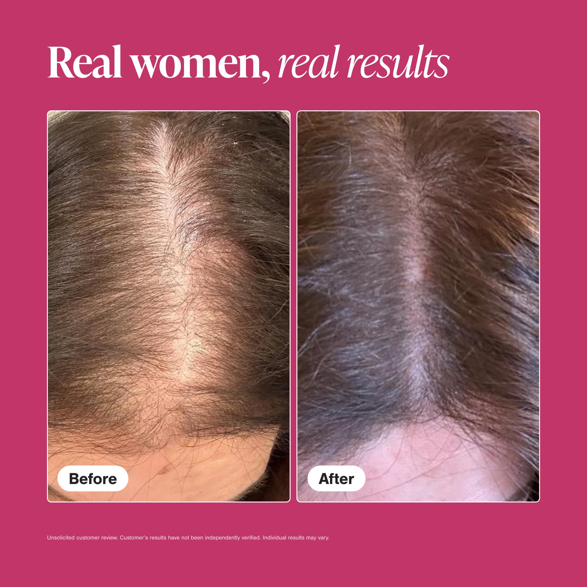 Woman taking Viviscal tablet demonstrating simple routine and adherence benefit