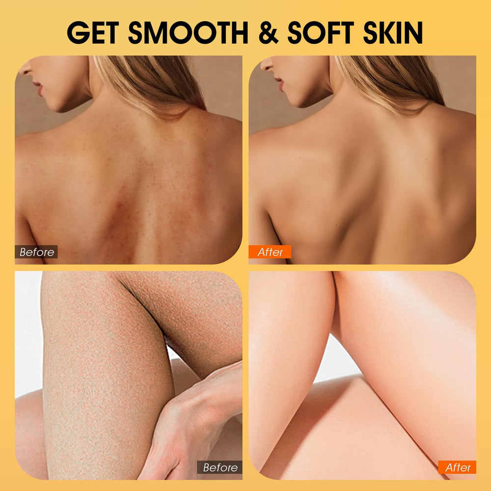 VOERUY foot scrub in use on heels showing smoothing and softening benefit