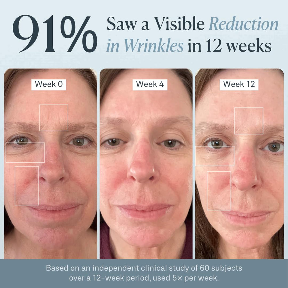 VogueNow mask showing enhanced lip and chin contours for targeted coverage