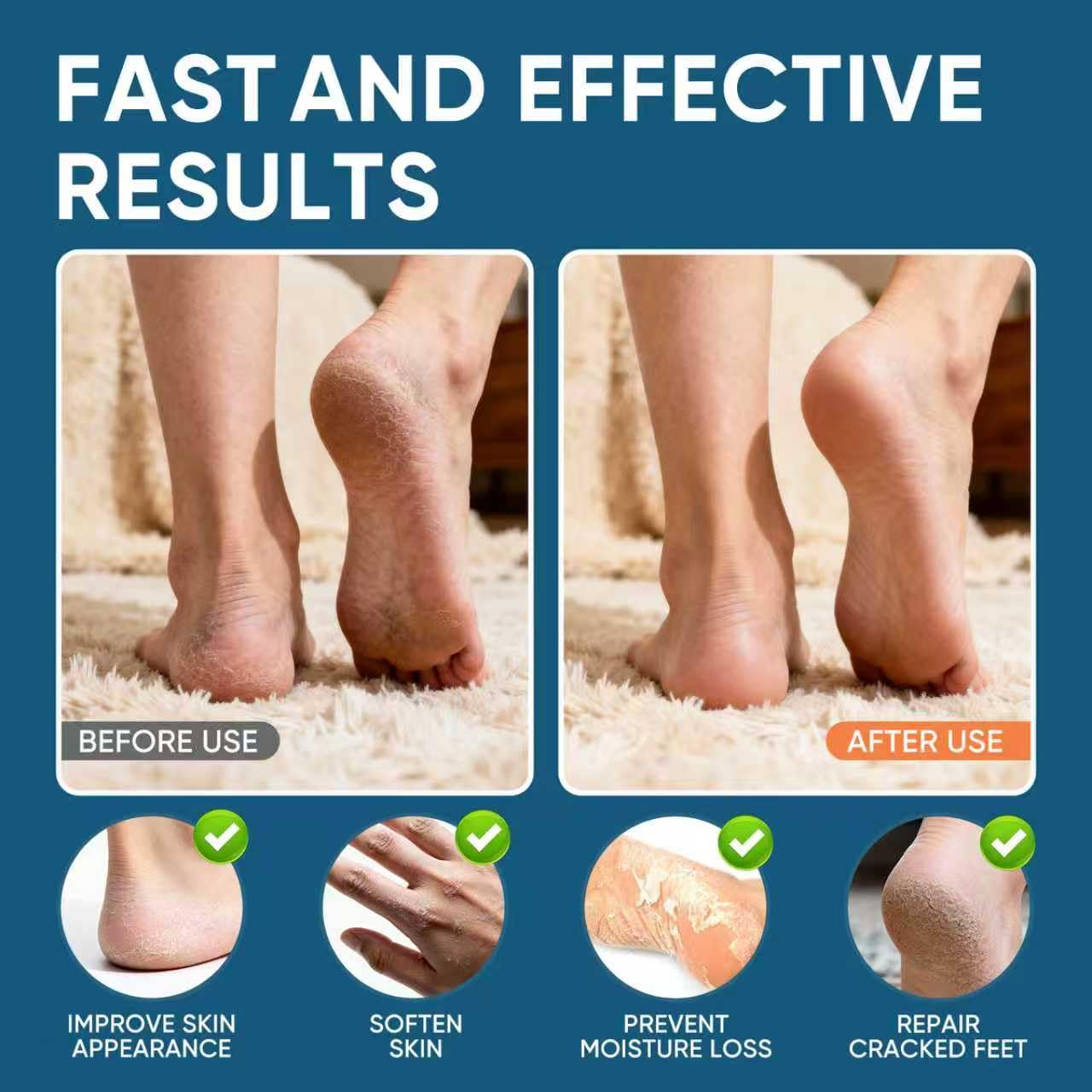VREKEF being applied to heel to soften calluses and improve comfort