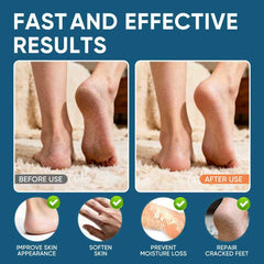 VREKEF being applied to heel to soften calluses and improve comfort