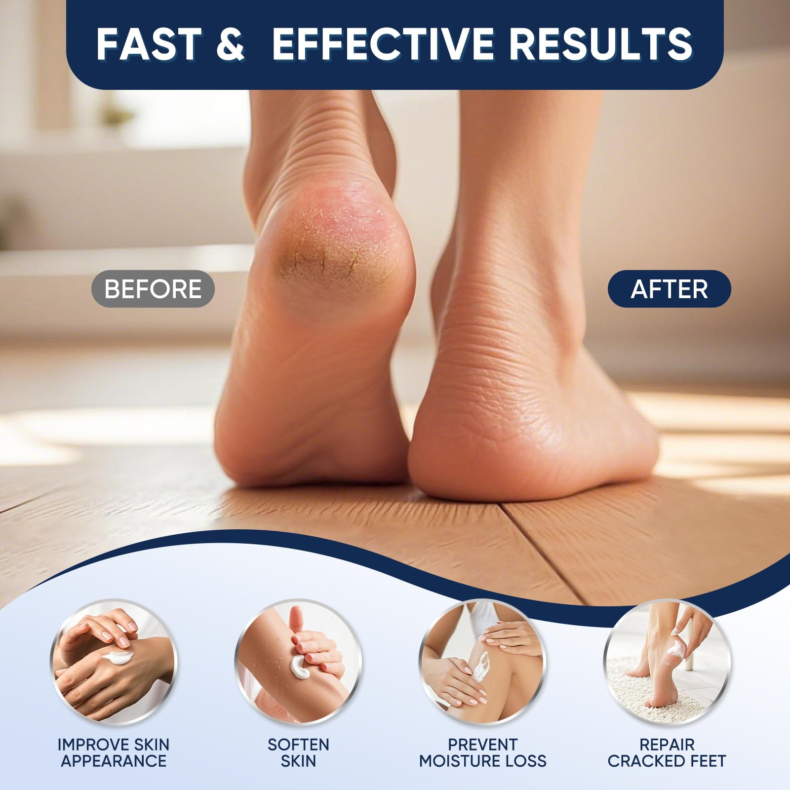 VREKEF applied to heel close-up demonstrating softening effect
