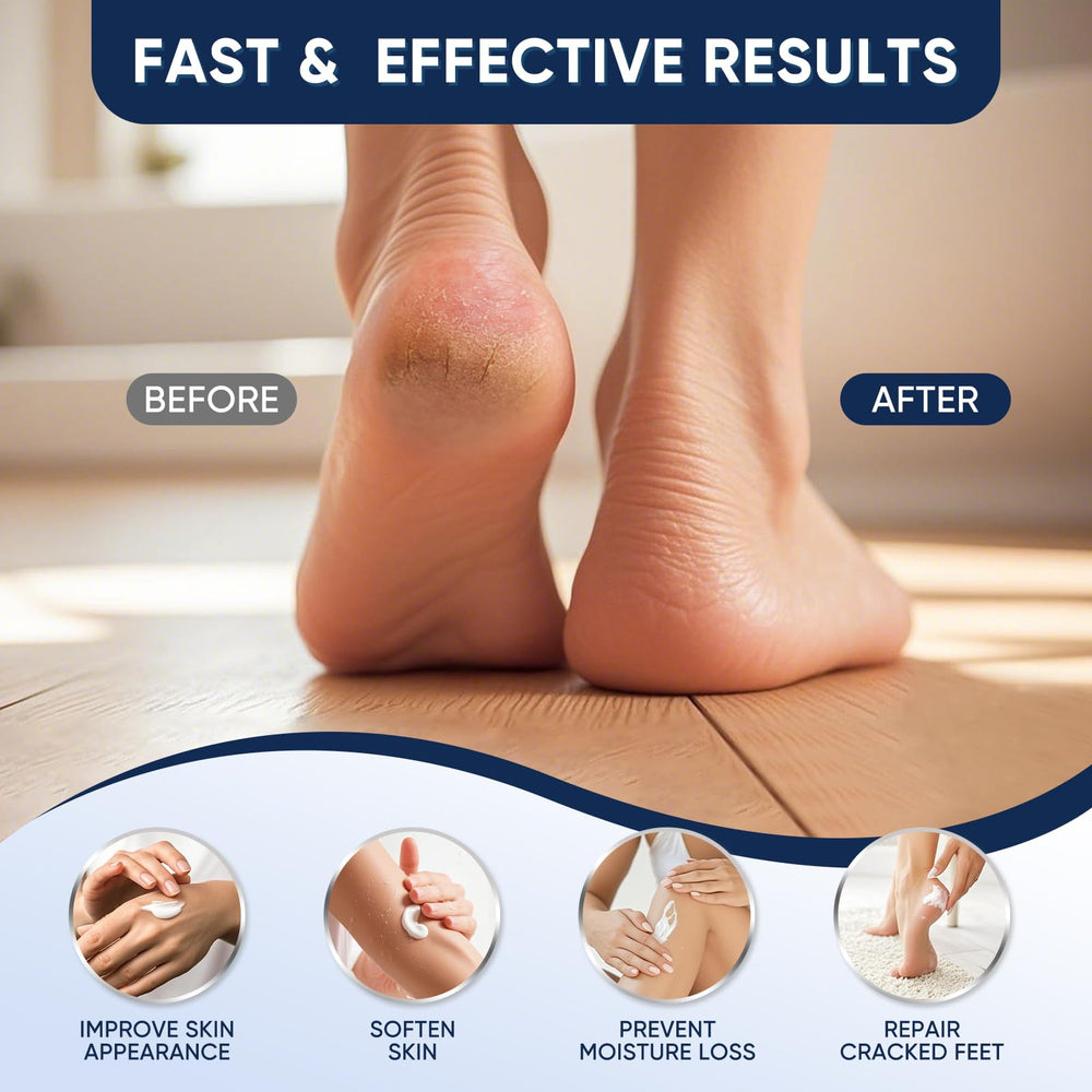 VREKEF applied to heel close-up demonstrating softening effect