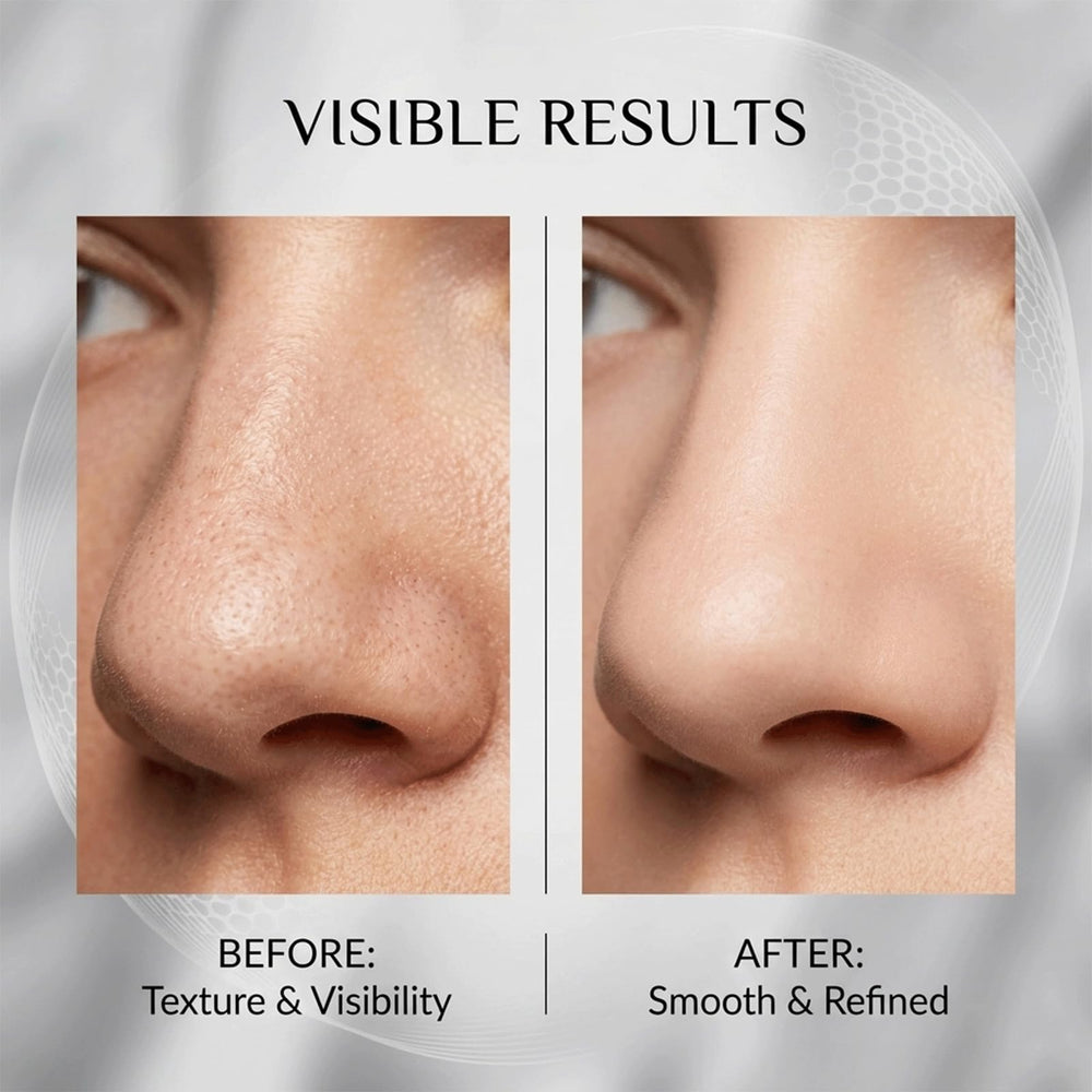 Vue Swiss patch removed showing gentle adhesive and minimal residue benefit