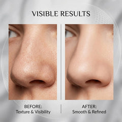 Vue Swiss patch removed showing gentle adhesive and minimal residue benefit