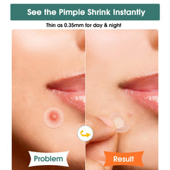 WakeALL contour patch applied to nose offering discreet coverage
