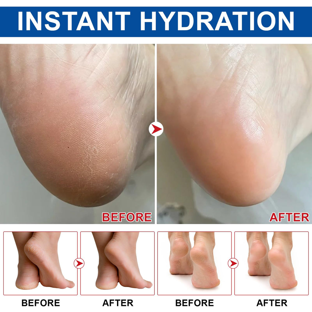 Weluno stick used on elbow and knee for smoothing rough skin benefit