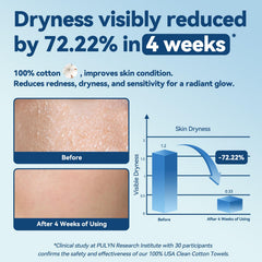 Winner towel in hand removing makeup gently, protects sensitive skin