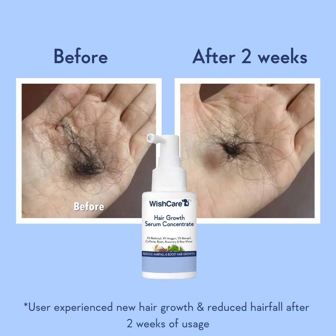 WishCare before and after comparison illustrating improved hair density and fuller appearance