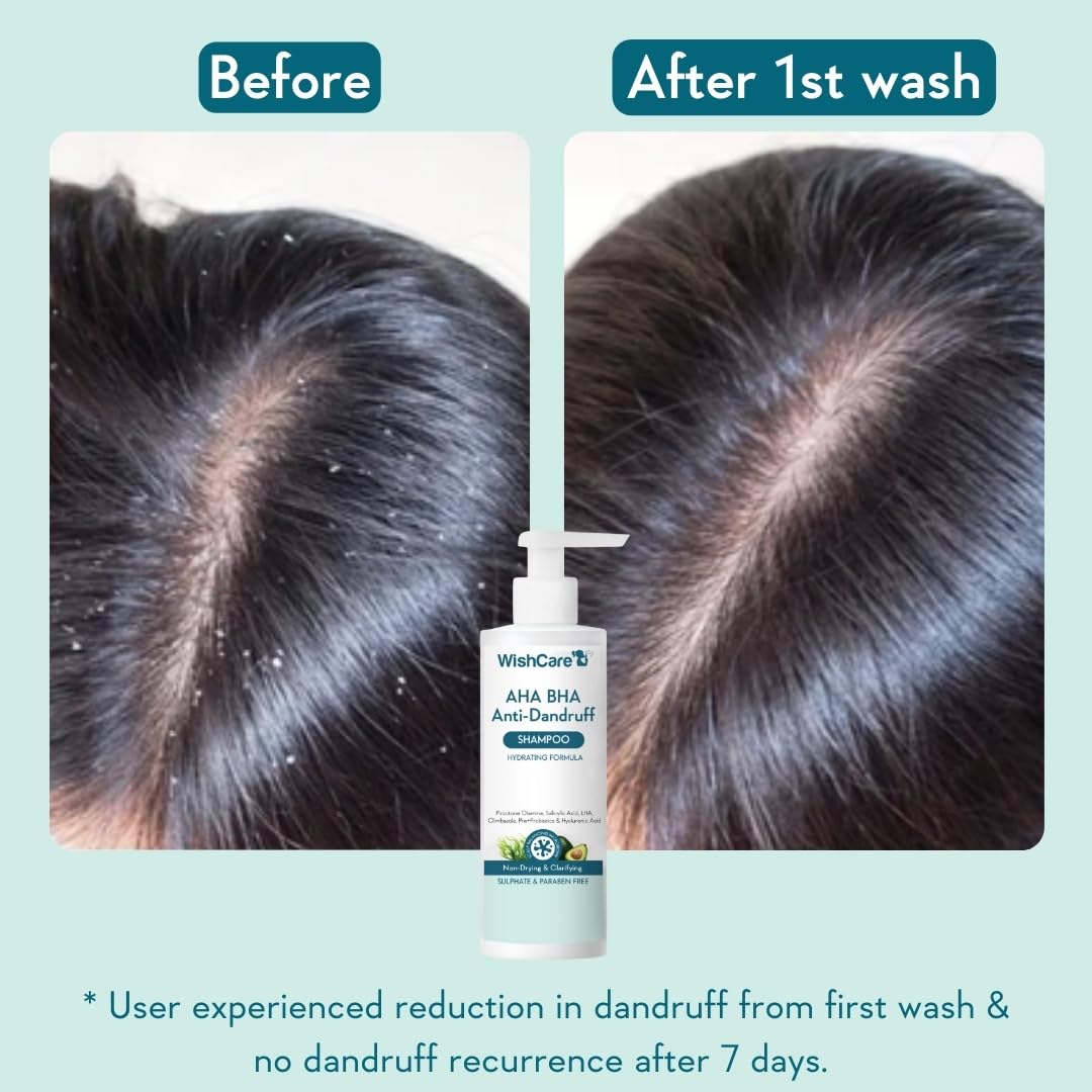 WishCare texture being dispensed from pump illustrating smooth application and control
