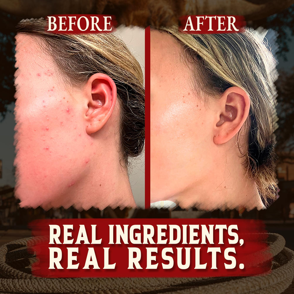 Wrath & Remedy applying balm to hand illustrating quick absorption and soothing benefit