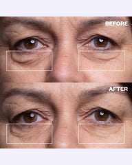 Wrinkles Schminkles being applied under eye demonstrating comfortable overnight wear