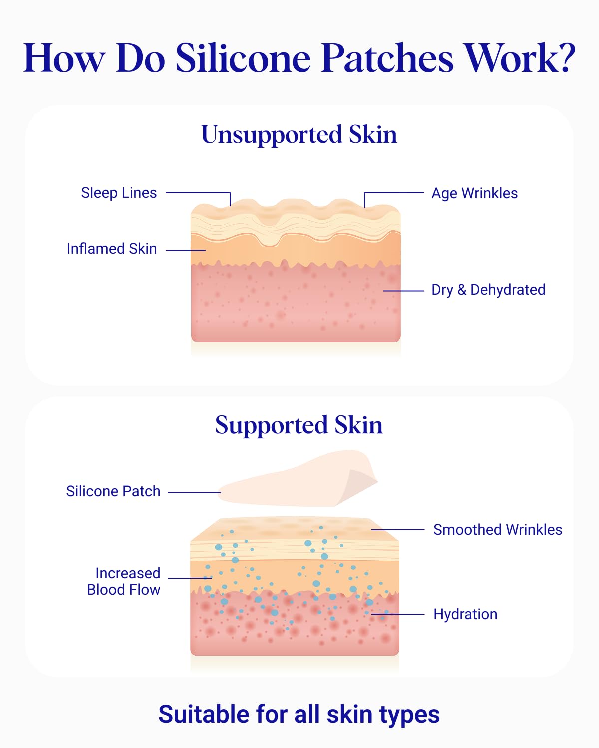 Wrinkles Schminkles storage sheet with patches to preserve adhesive and reuse