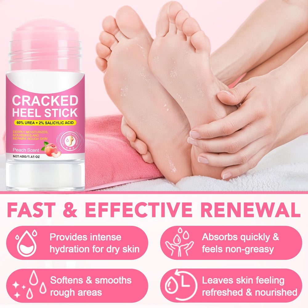 XIAMOFUZHOU before and after feet comparison highlighting softer, smoother heels