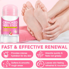 XIAMOFUZHOU before and after feet comparison highlighting softer, smoother heels