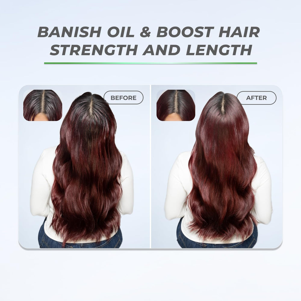 XMONDO saw palmetto ingredient display conveying scalp-supporting benefits