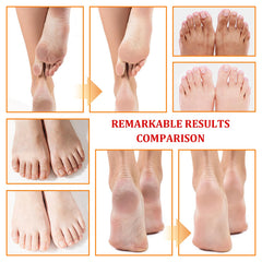 XMXueMei before and after feet showing smoother, exfoliated result