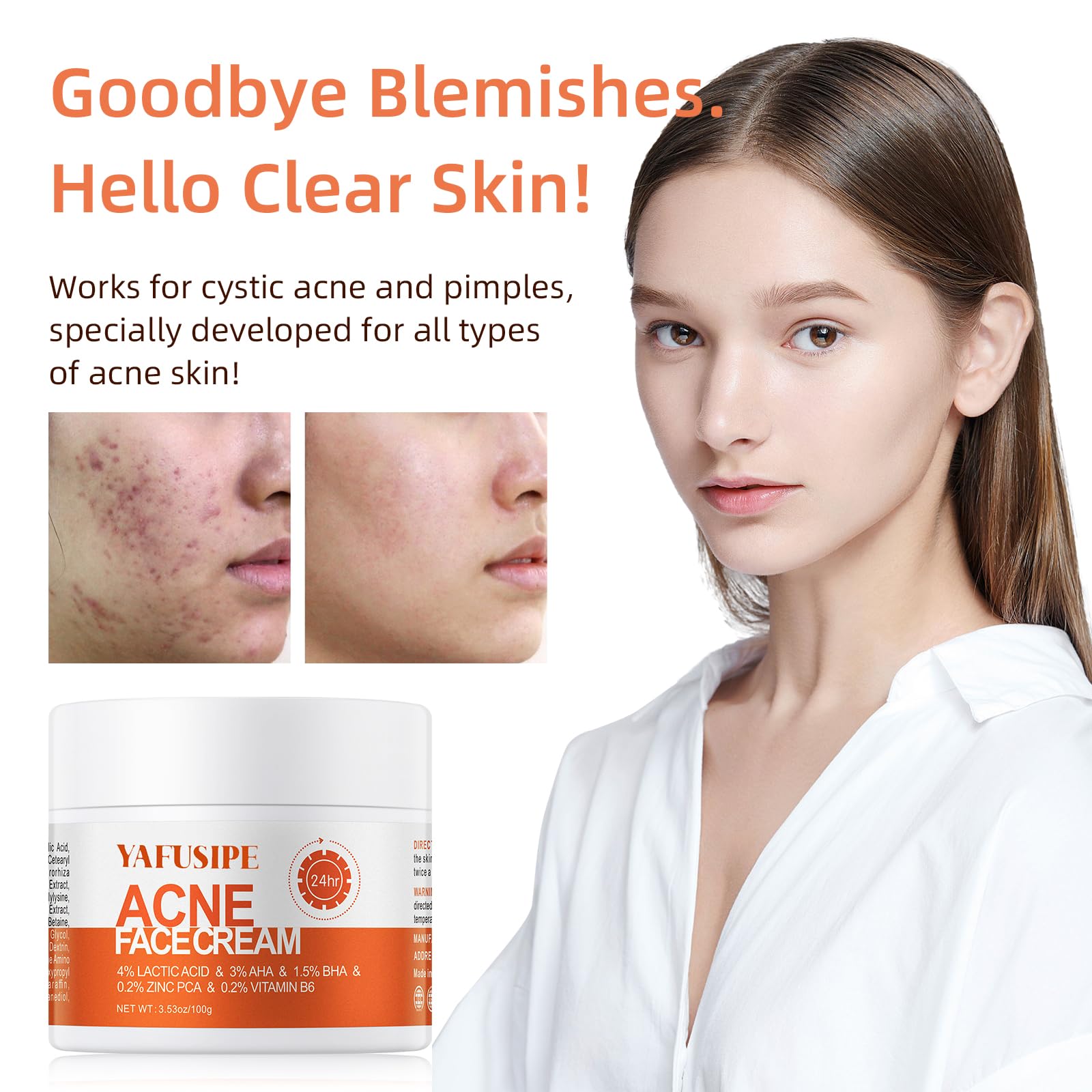 YAFUSIPE applying cream to back acne area for targeted control