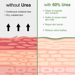 yafusipe foot repair before after lifestyle showing smoother heels