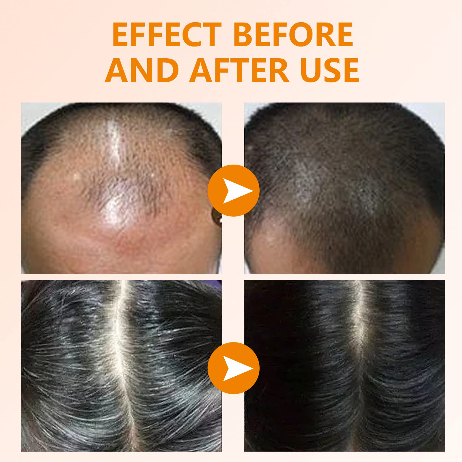 YAFUSIPE turmeric and ginger ingredient texture close-up highlighting natural actives