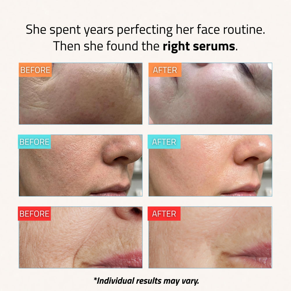 YEOUTH hyaluronic acid serum applied to skin for instant hydration