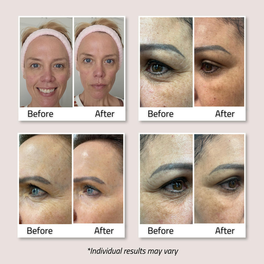 YEOUTH shown applied along neck for firmer-looking skin