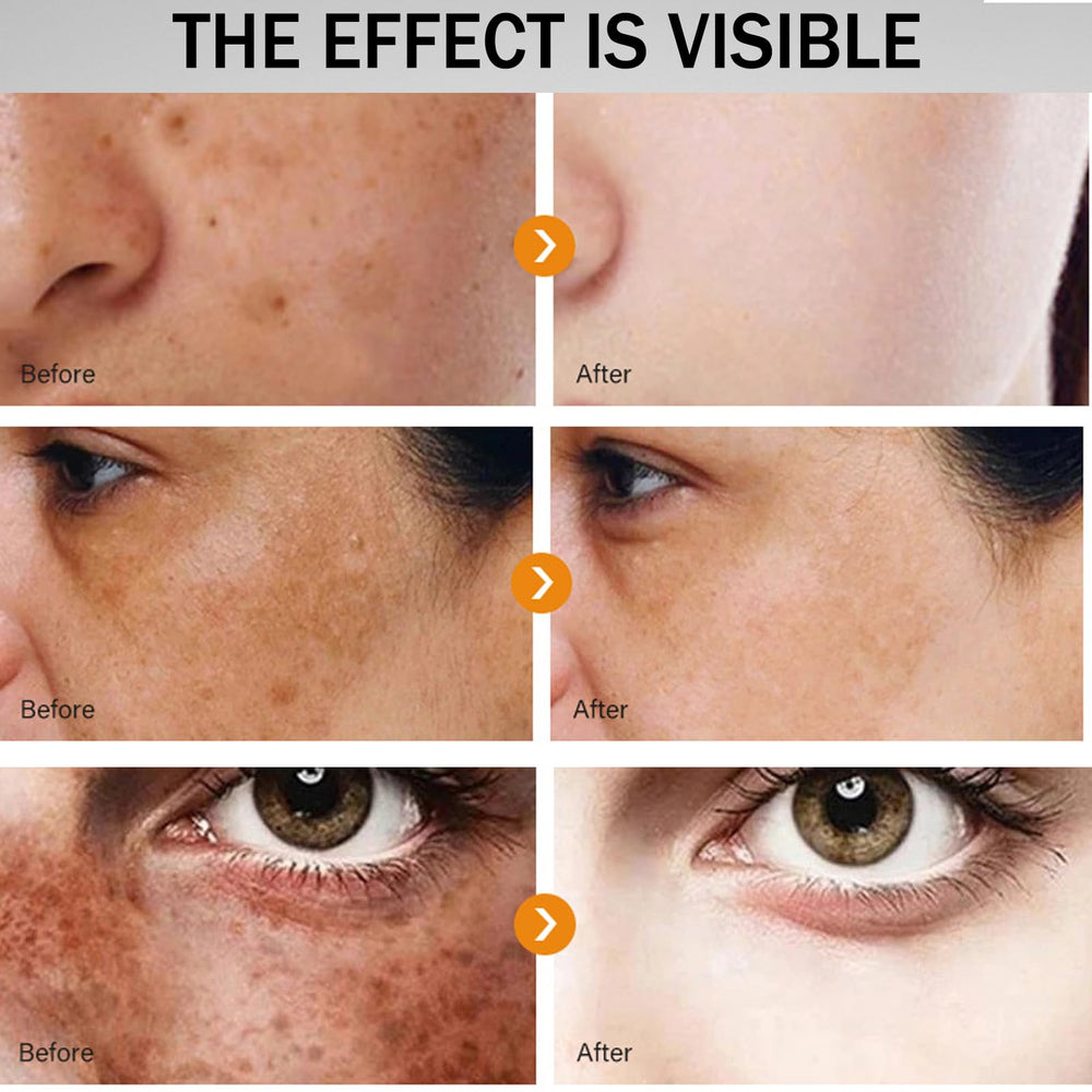 Yeweian before and after sample swipe illustrating visible spot reduction over time