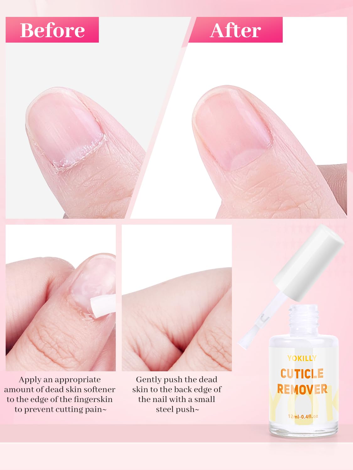 Yokilly cross-section of double-layer design retaining heat and protecting acetone