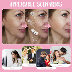 YONMUY neck lift detail highlighting natural-looking skin smoothing
