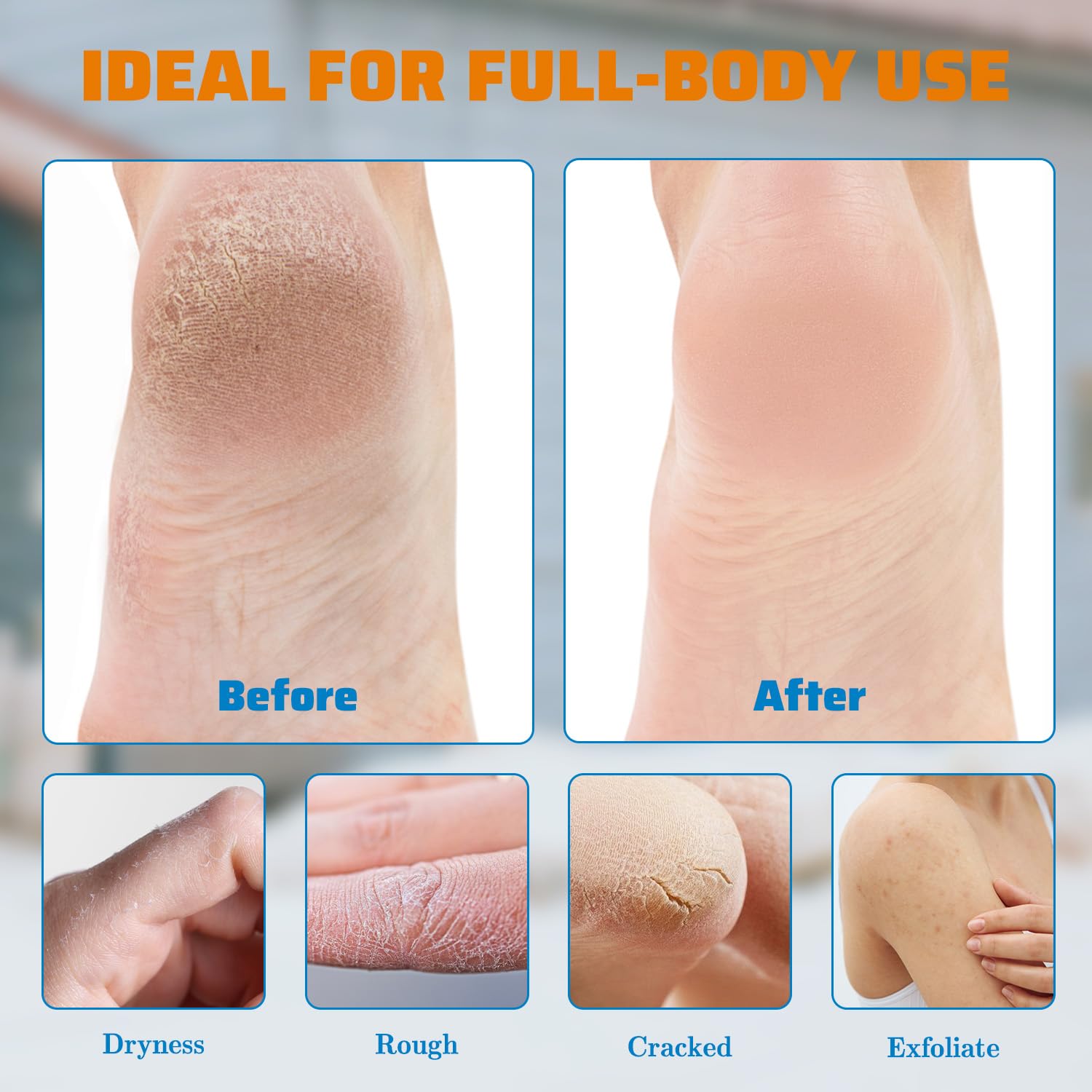 YOUNGYOUNGLOVE being applied to heels to soften rough skin