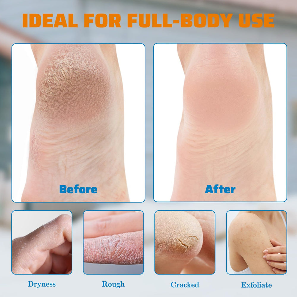 YOUNGYOUNGLOVE being applied to heels to soften rough skin