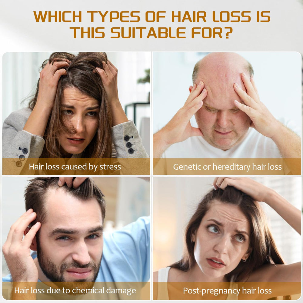 YOUNGYOUNGLOVE ingredient label highlighting minoxidil and biotin for strengthened strands