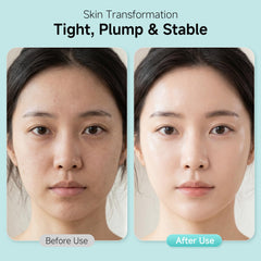YUOJUNES ingredient display with peptides and hyaluronic for firming