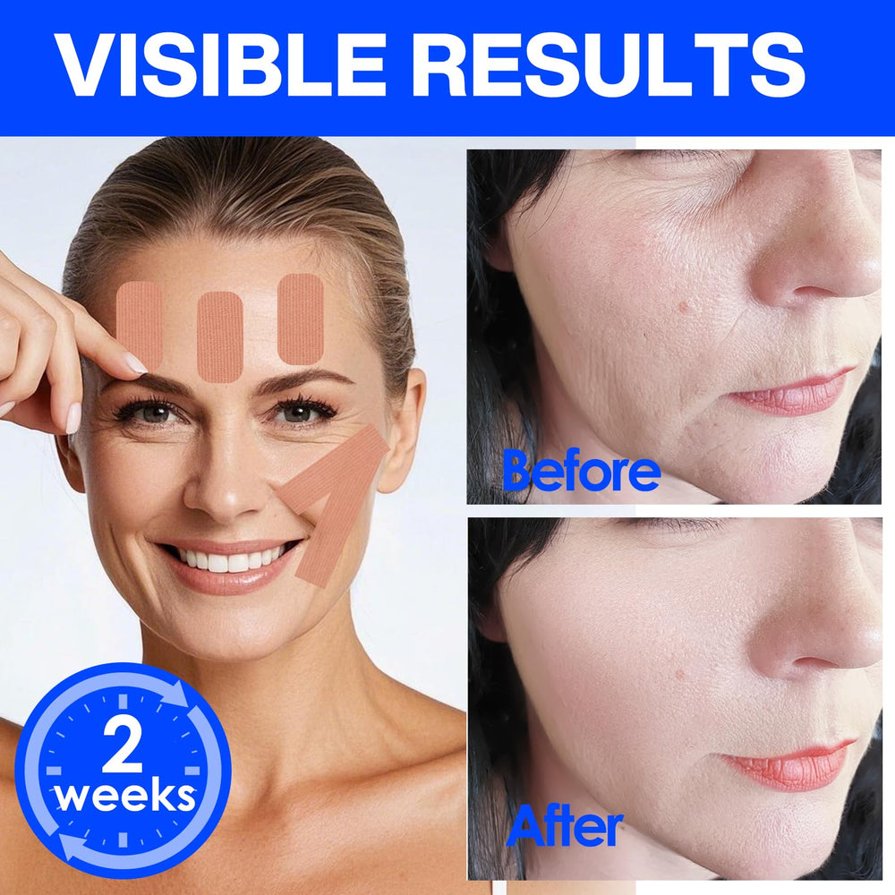 zancony tape applied on forehead demonstrating gentle lifting benefit