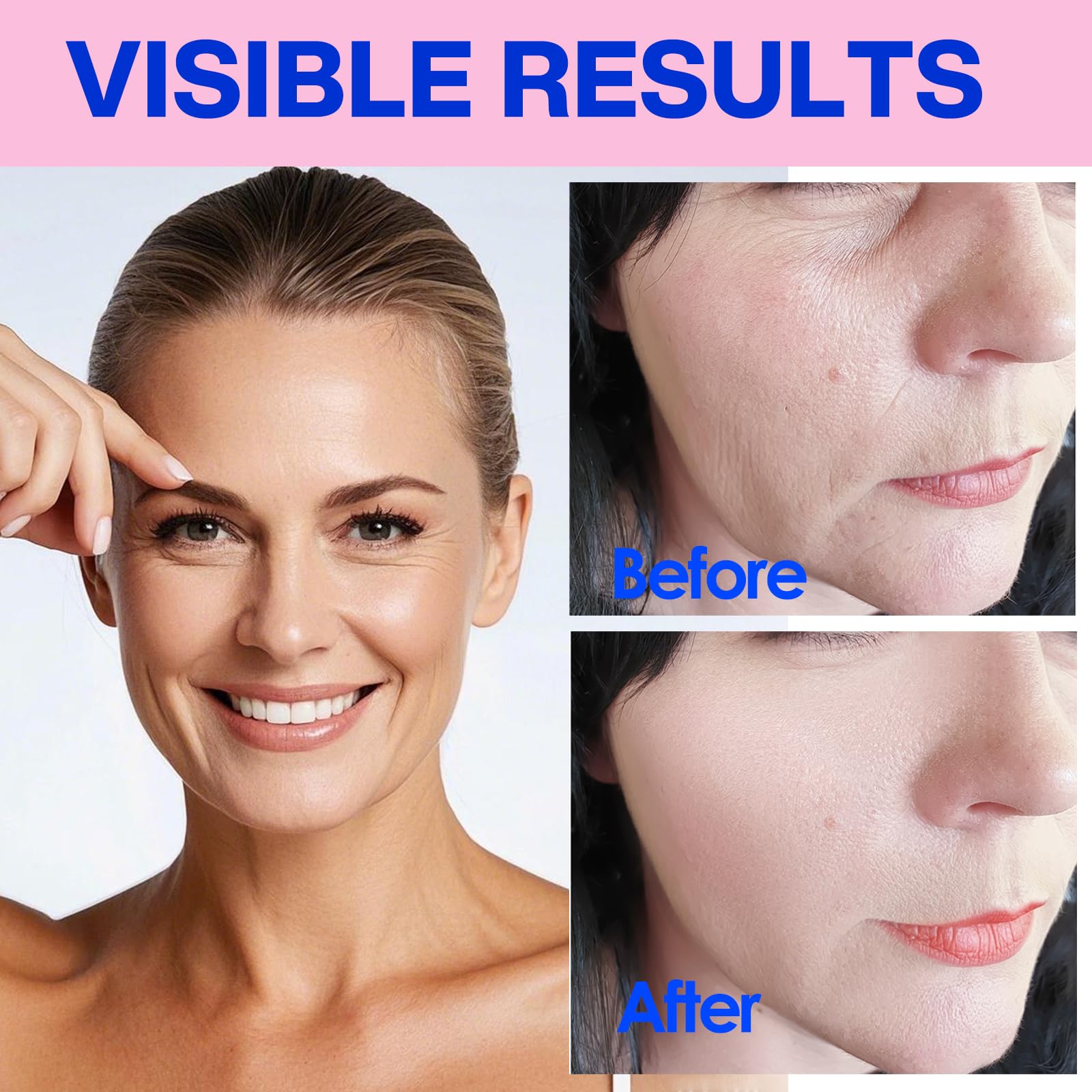zancony applied on forehead overnight demonstrating smoothing benefit