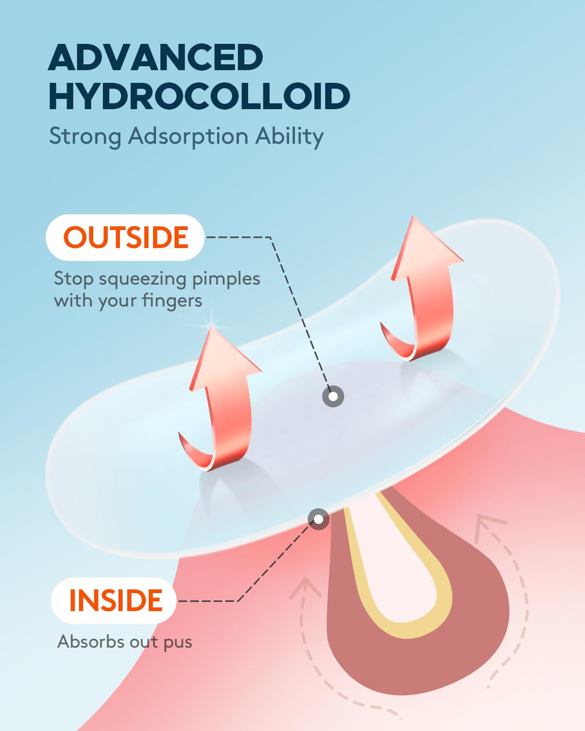 ZATKTK close-up of hydrocolloid texture highlighting strong absorbency