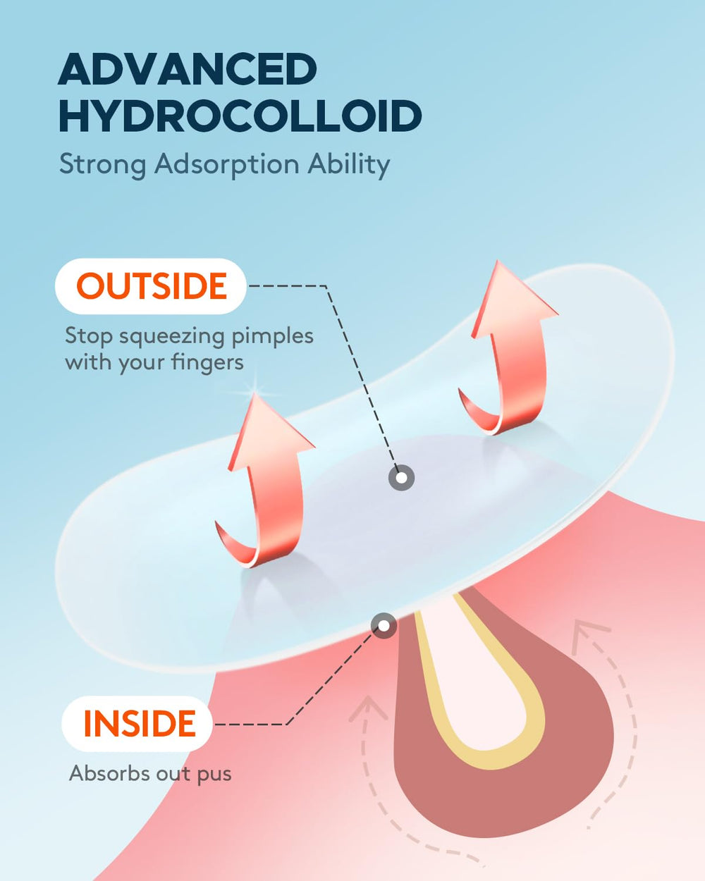 ZATKTK close-up of hydrocolloid texture highlighting strong absorbency